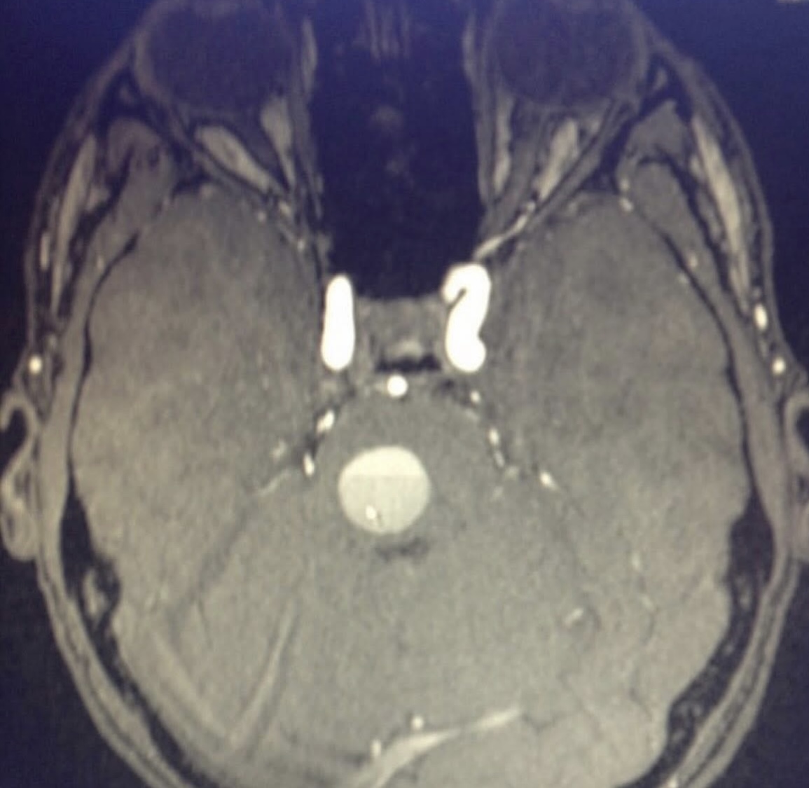 20. Is that a golf ball in my brain!?
